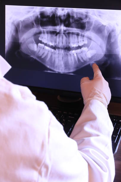 Best Emergency Dental Surgery in Moorefield, WV