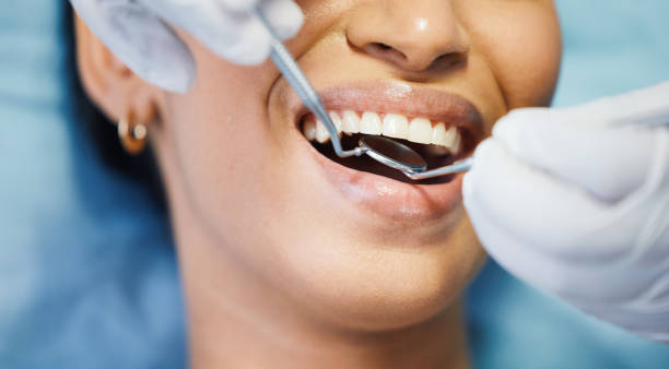 Best Emergency Root Canal Treatment in Moorefield, WV